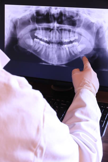 Best Walk-In Emergency Dentist in Keowee Key, SC