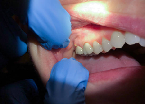 Best Emergency Dental Care for Trauma or Injury in Keowee Key, SC