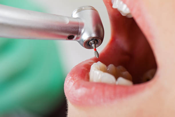 Best Emergency Broken Tooth Repair in Keowee Key, SC